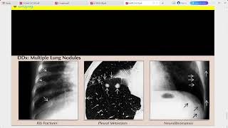 RADIOLOGY EXAM CASES [upl. by Asli]