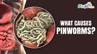 What Causes Pinworms  Pinworm Symptoms  Best Learning Videos For Kids  Plufo [upl. by Enylhsa342]