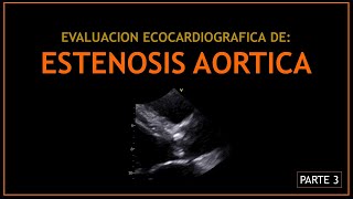 ESTENOSIS AORTICA Evaluacion ecocardiografica  PARTE 3 [upl. by Aushoj688]