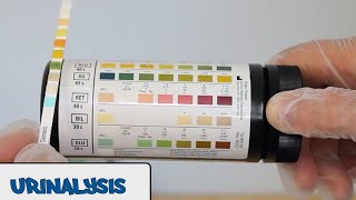 Urine Dipstick TestPrincipleProcedureResults [upl. by Helene75]