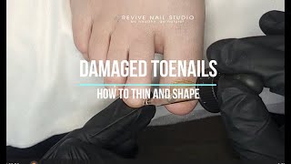 Do you have THICK DAMAGED toenails How to thin and shape thicknails pedicuretutorial nails [upl. by Saunderson]