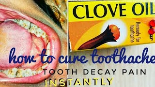 😥How To CURE Tooth Pain  Dos and Donts  CLOVE OIL BENEFITS  The Best Toothache RELIEVER [upl. by Earb]