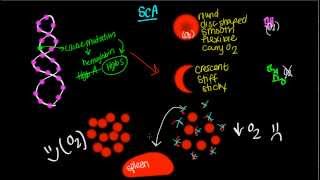 Pathophysiology of Sickle Cell Anemia [upl. by Shepard]