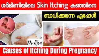 Itching During Pregnancy Malayalam  Pregnancy Strech Mark  Cholestasis [upl. by Danica]