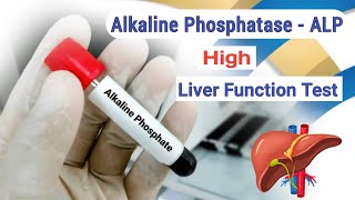 Alkaline Phosphatase Test  Liver Function Test  ALP  High Result [upl. by Abrahams]