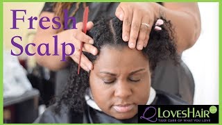 Fresh Scalp Treatment [upl. by Canotas327]