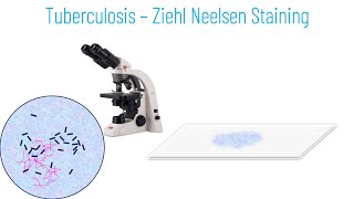 Ziehl Neelsen Staining Principle and Procedure [upl. by Flanigan]