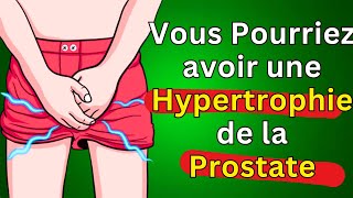 Hypertrophie de la prostate  Signes et symptômes  Ce Que Vous Devriez Savoir [upl. by Nnanerak467]