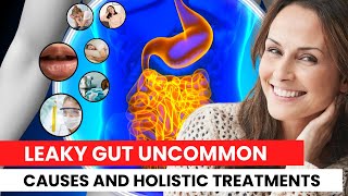 10 Uncommon Causes of a Leaky Gut and Holistic Treatments [upl. by Atilemrac]