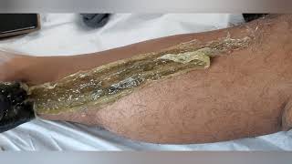 how to make sugaring paste and leg sugaring video [upl. by Atalante704]