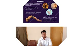 Tetanus Disease overview in Hindi amp Urdu [upl. by Rosa]