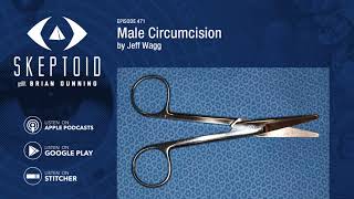 Male Circumcision [upl. by Puett529]