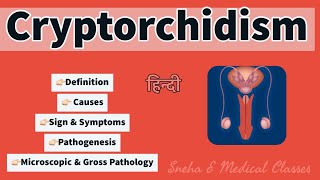 Cryptorchidism  Pathology  Microscopic and Gross Pathology  Pathogenesis [upl. by Battiste486]