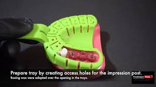 Impression Techniques for Implant Dentistry Step by Step Splinted open tray Impression technique [upl. by Ahsatin]