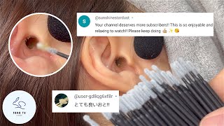 ASMR  ミクロスワブで最高の耳かき体験  Best Ear Cleaning Experience With Micro Swabs [upl. by Tirma]