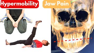 Jaw Pain and Hypermobility Is it ALL connected [upl. by Esir]