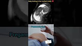 Baby moving inside the mother womb ♥️🥰shorts pregnant motherwomb [upl. by Drexler]