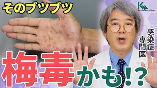 感染者数が過去最多！梅毒にかかるとどうなるの？感染症の専門医が解説！ [upl. by Klug967]