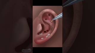 ASMR Ear Cleaning amp Treatment  Gentle Relaxation for Sleep amp Stress Relief asmr asmrtapping [upl. by Yerac]