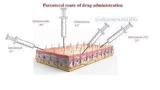 Parenteral routePart 2Routes of Drug administration pharmacology pharmacy [upl. by Alliscirp]