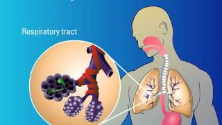 Recognition of Fungi and Activation of Immune Response [upl. by Neliak816]