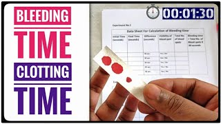 Blood clotting time by capillary tube methodCT test mlt dmlt labtechnician shorts [upl. by Humbert]