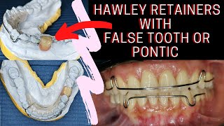 Hawley RETAINERS with FALSE TOOTH or Pontic  PHILIPPINES [upl. by Acebber515]