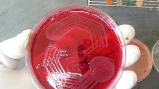 Shigella spp biochemical amp its Growth on various media [upl. by Husch]