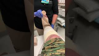 Compression Bandaging for Lymphedema [upl. by Lamdin]