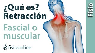 Retracción muscular o fascial  Qué es y cuáles son sus causas [upl. by Nattie]