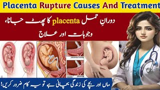 Hamal Ke Doran Placenta Ka Phat Jana Wajuhat Or ilaj  Placenta Rupture Causes And Treatment [upl. by Leipzig]