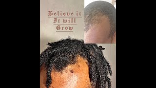 My Hair growth Reishi Journey Fish Oil Benefits [upl. by Nnadroj]