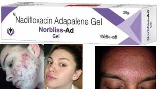 Norbliss Ad Gel Nadifloxacin Adapalene Gel [upl. by Harrad]