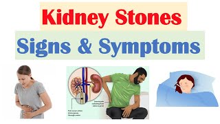 Kidney Stones Nephrolithiasis Signs amp Symptoms  amp Why They Occur [upl. by Ecnahoy]