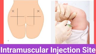 Intramuscular Injection Sites [upl. by Notac]