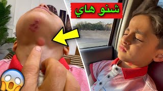 شي غربي طلع في رقبت يمان 😨 [upl. by Cyndy262]