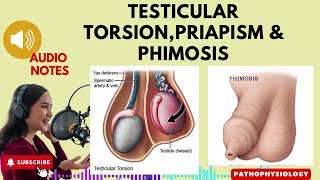 Testicular Torsion Priapism and PhimosisParaphimosis [upl. by Lenroc]