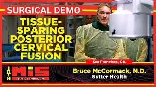 Tissue Sparing Posterior Cervical Fusion  Bruce McCormack MD [upl. by Lednor]