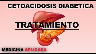 TRATAMIENTO CETOACIDOSIS DIABÉTICA  MEDICINA APLICADA [upl. by Adeirf531]