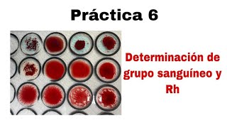 Práctica 6 Determinación de grupo sanguíneo y Rh [upl. by Morel]