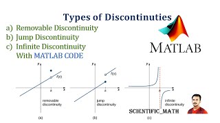 Explain Types of Discontinuities l Function l Continuity l Types of Discontinuities l Calculus [upl. by Ainesey]