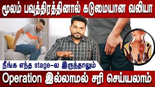 மிகக்குறைந்த நாட்களில் இதை குணப்படுத்தலாம் திரும்பவும் வராது Piles symptoms treatment Mr ladies [upl. by Stelle]