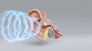 Explore the Science of Hearing Loss  MiracleEar Hearing Center [upl. by Draper]