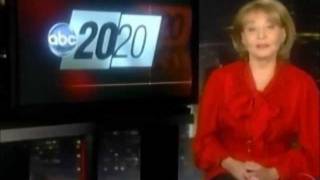 Ultherapy on Barbara Walters 2020 Special [upl. by Suoiluj]