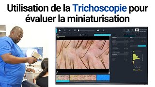 Utilisation de la Trichoscopie pour évaluer la miniaturisation  Aperçu avec Bisanga 26 [upl. by Georglana]