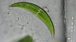 Crescent Shaped Algae Closterium moniliferum [upl. by Philana]