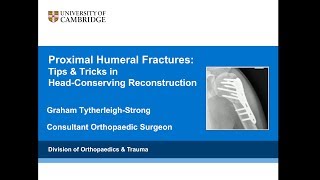 Proximal Humeral Fractures Tips amp Tricks for Head Conserving Surgery [upl. by Rovit975]