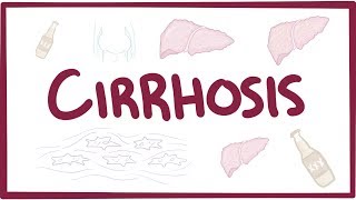 Cirrhosis  causes symptoms diagnosis treatment pathology [upl. by Pacificia181]