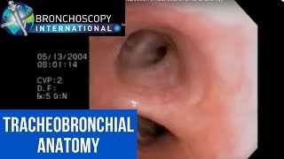 Flexible Bronchoscopy Introduction 7  Airway Inspection Tracheobronchial Anatomy [upl. by Solram]