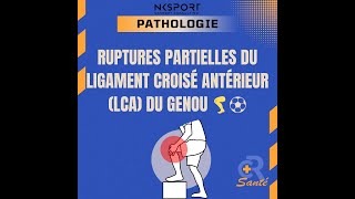 Rupture Partielle du LCA  Comprendre Diagnostiquer et Traiter LCA Kinésithérapie [upl. by Maccarthy]